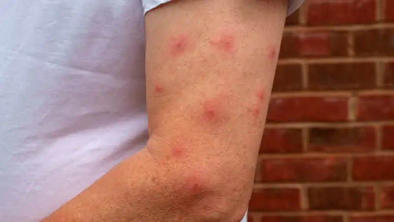 Vektörle mücadele ve ilaçlama hizmeti önem kazandı